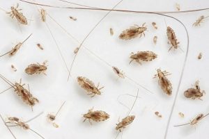 Lire la suite à propos de l’article Comment prévenir l’infestation de poux après un traitement : Conseils et astuces